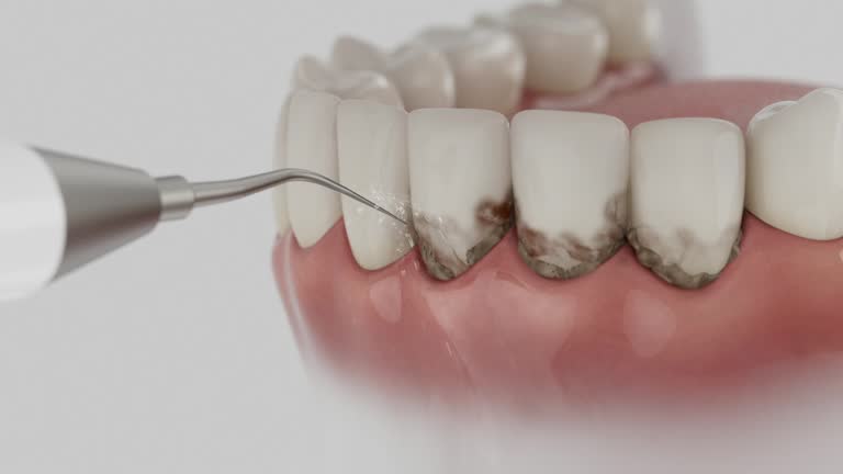 Reliable Dental contractor in Vail, CO by Dentist Open Now